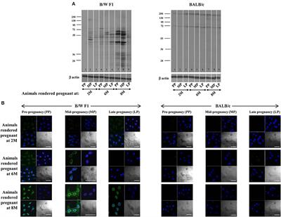 Human <mark class="highlighted">Chorionic Gonadotropin</mark> Influences Systemic Autoimmune Responses